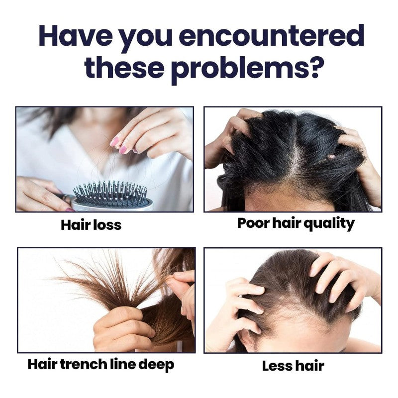 FEG Plus Hair Growth Spray